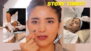 My Experience With Hydra Facial | Will I Do It Again? | Story Time