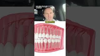 Czy Usuwanie Ósemek Boli  (Animacja 3D Dentystyczna)