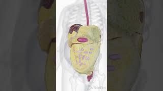 ️ Visceral Fat: The Hidden Fat Around Your Organs ️
