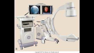 The X Ray Imaging System  (A)