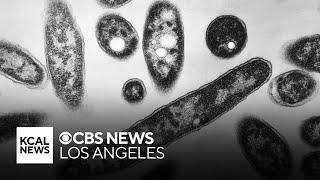 Orange County health officials issue warning after several cases of Legionnaire's Disease reported