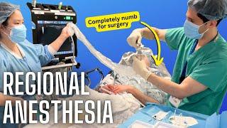 How anesthesiologists numb specific body parts (actual video of a nerve block)