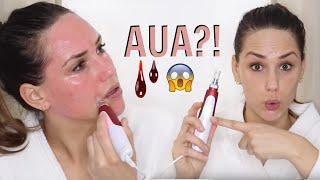 MICRONEEDLING FÜR ANFÄNGER | DERMAPEN TUTORIAL ANLEITUNG || KathisFinest