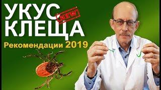 Укус клеща - что делать? Новые рекомендации СDC и AMMI 2019