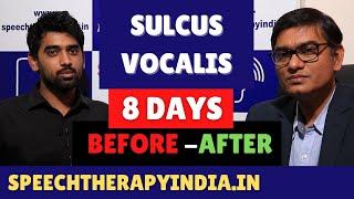 Pre-Post | Sulcus Vocalis | 8 Days Voice Therapy | By SLP Sanjay Kumar | Breathy Voice Treatment