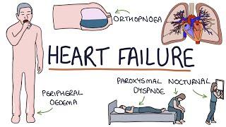 Understanding Heart Failure: Visual Explanation for Students