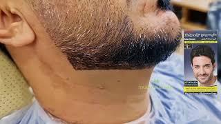 Amazing Tricks For Beard Line#adi #beard #youtube #barber @Turkishbeard