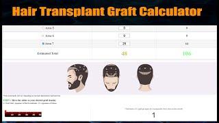 Hair Transplant Graft Calculator