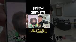 (#BJ조선참새)두피문신 2회차인데 이정도라고?! #shorts