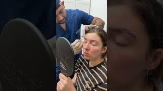 Eyebrow Transplant as Good as Shinobi Lineage | Cara Clinic