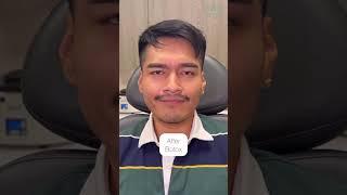 Botox: Before + After