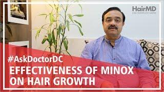 How effective is minoxidil for hair growth | HairMD, Pune