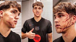 Pau Cubarsí  ● THE WARRIOR ● Crazy Tackles & Blocks 2024 - HD