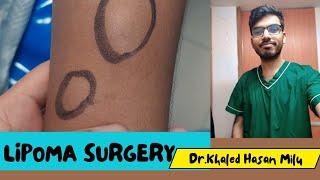 Lipoma Surgery