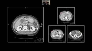 Proximal Gastrointestinal Emergencies | Interesting Radiology Cases