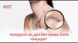 ТЕРИДАГИ ОҚ ДОҒЛАР НИМА УЧУН ЧИҚАДИ? НИМА ҚИЛСАК БЎЛАДИ?