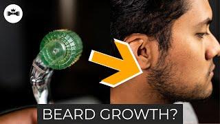 Derma Roller for Beard | What You Need to Know | Microneedling