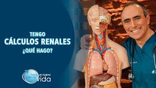 TENGO CÁLCULOS RENALES ¿QUÉ HAGO? - HACIA UN NUEVO ESTILO DE VIDA