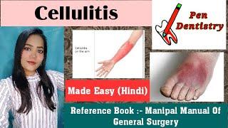 Cellulitis  #pendentistry #dentalstudy #dentallecture #ayshwaryakanojia #doctor #cellulitis