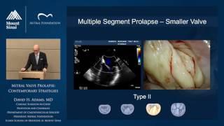 Mitral Valve Prolapse: Contemporary Strategies