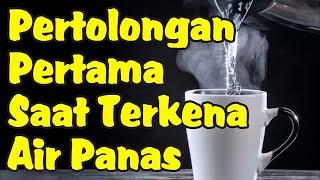 Pertolongan Pertama Saat Terkena Air Panas Mendidih