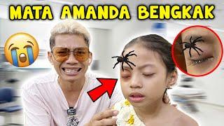 GAWAT MATA AMANDA BENGKAK DIGIGIT LABA-LABA BERACUN!!