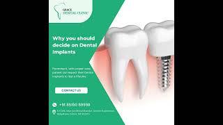 Grace Dental Clinic - Best Dental Clinic in Indore | Best Dentist in Indore