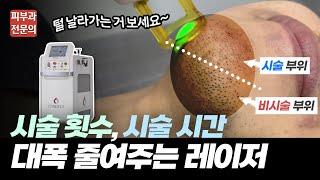 남자 제모 1등! 젠틀맥스 프로 플러스 | 수염 가슴 다리 등 부위별 제모 영상 공개