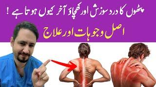 Myalgia Muscle Pain Treatment In Urdu Hindi - Dr Irfan Azeem