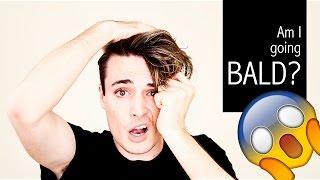 Am I going BALD? Baldness Prevention Tips | Mens Hair Loss Tips