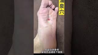 湧泉穴：足少陰腎經之「井穴」Yongquan Point: "Jing Point" of the Kidney Meridian of Foot Shaoyin