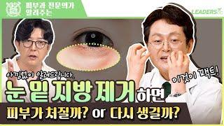 눈 밑 지방 제거하면 I 피부가 처질까? or 다시 생길까?