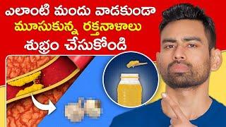 మూసుకున్న రక్తనాళాలను (Blocked Arteries) శుభ్రం చేయండి ఈ 5 పదార్థాలతో | Fit Tuber Telugu