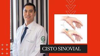 Synovial Cyst