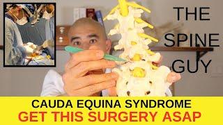 Surgical Treatment for Cauda Equina Syndrome