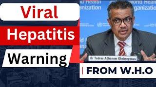 Viral Hepatitis warning from W.H.O. Update on hepatitis eradication