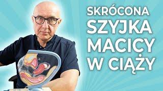 Skrócona szyjka macicy w ciąży. Czy muszę leżeć w łóżku?