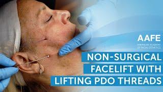 Non-Surgical Facelift with Lifting PDO Threads! | AAFE