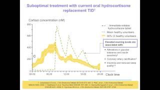 Nurses Session 4, Hypopituitarism post-surgery and quality of life: Sofia Llahana