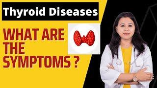 Causes of THYROID Problems, Thyroid Symptoms, Thyroid Problems in Women | Dr Arpana Samanta