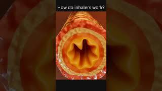 How do inhalers work?.