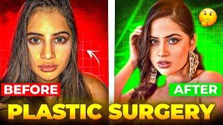 Top Bollywood Celebrities Who Used Plastic Surgery Ft. Urfi Javed | Celeb Sansar