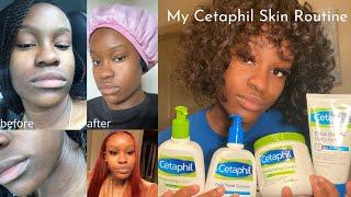 CETAPHIL SKINCARE ROUTINE (day + night) | how to treat acne & excema