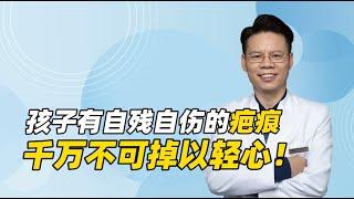 成都一初中生校内自缢，父母如果看到孩子身上有自残自伤的疤痕，千万不可掉以轻心！