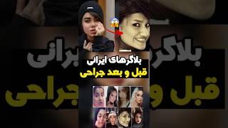 بلاگرهای معروف ایرانی قبل و بعد از عمل زیبایی!!| فکت و دانستنی!!| #shorts