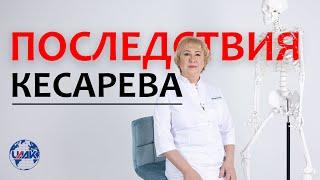 Кесарево сечение - каковы последствия? (проф.Васильева)