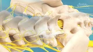 Discover Radiofrequency Lumbar procedure for patients by Boston Scientific