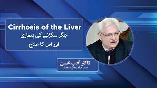 Cirrhosis of the Liver Treatment | Dr Aftab Mohsin