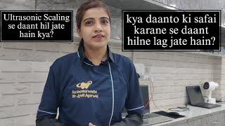 kya dental cleaning karane se daant hil jate hain??  Dr Jyoti agarwal | rj Dental World