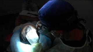 QA Follicular Unit Hair Transplantation | Scott Boden, M.D. | Connecticut (CT)